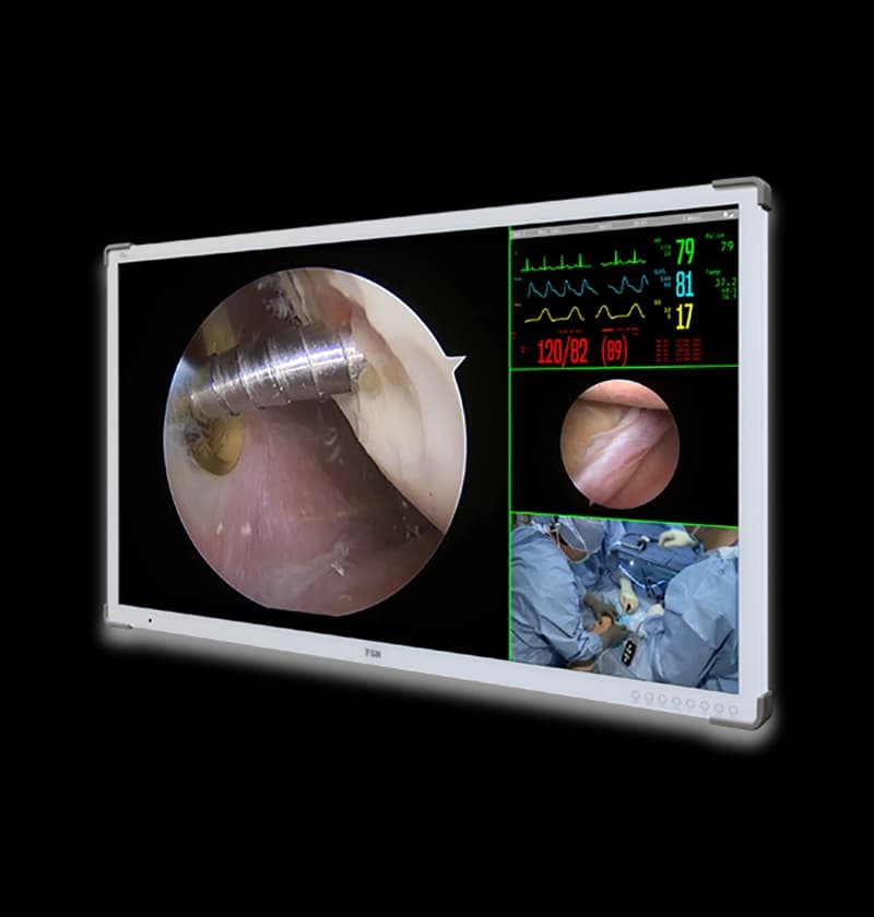 Medical Grade Monitor FSN FM-A5504DS-DG