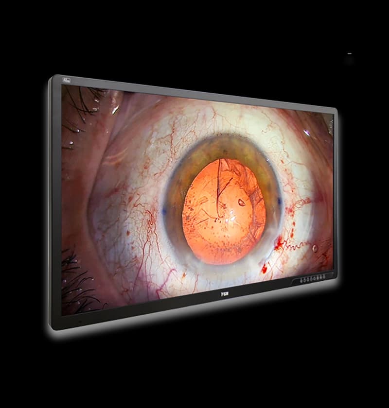 Medical Grade Monitor FM-A5505DGC