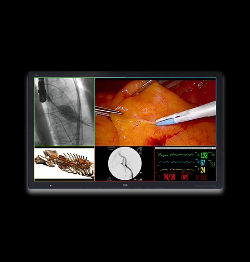 Medical Grade Monitor FSN FM-D5802DV